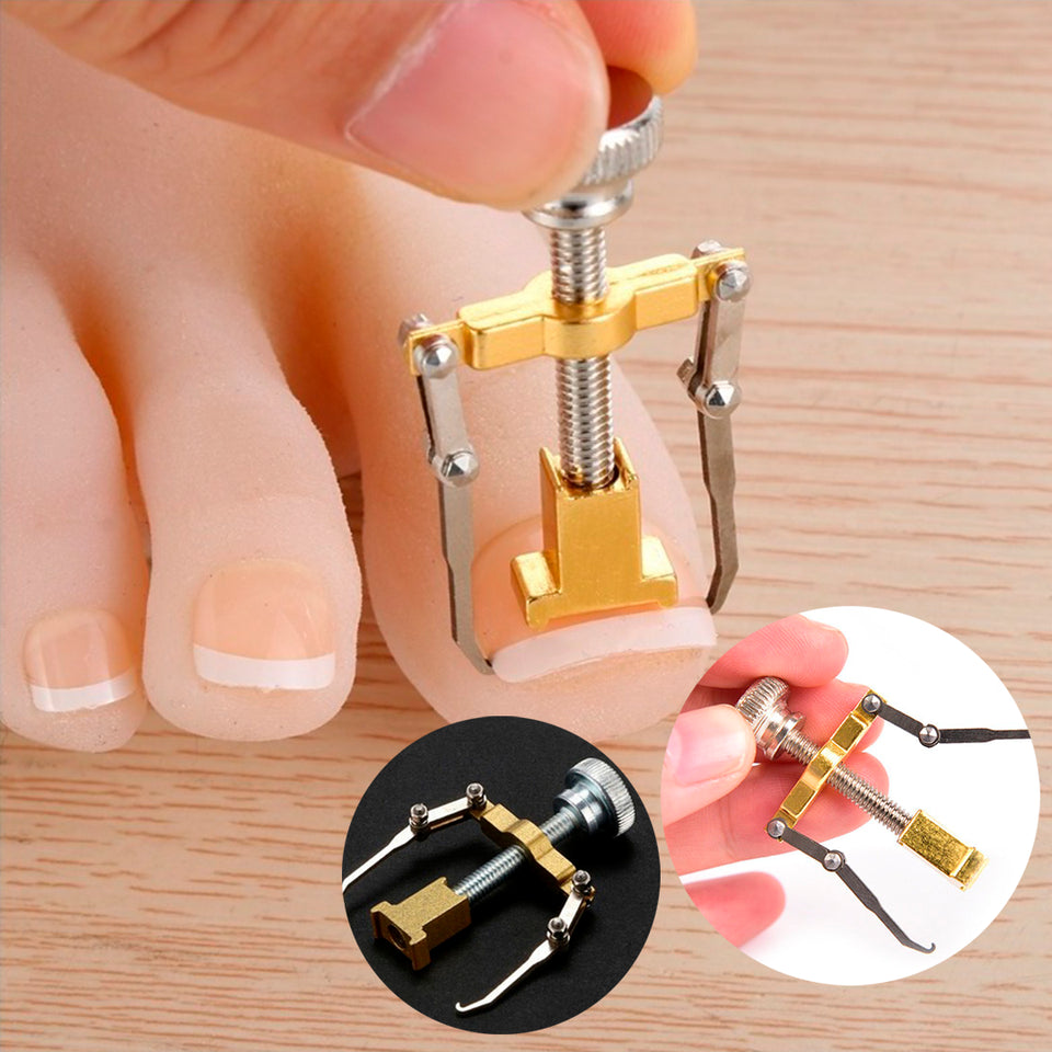 Herramienta Removedor De Uñas Enterradas